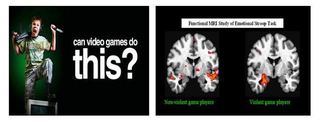 Violent Video Games Alter Youngsters Brains?