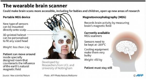 Wearable Brain Scanner Game Changer